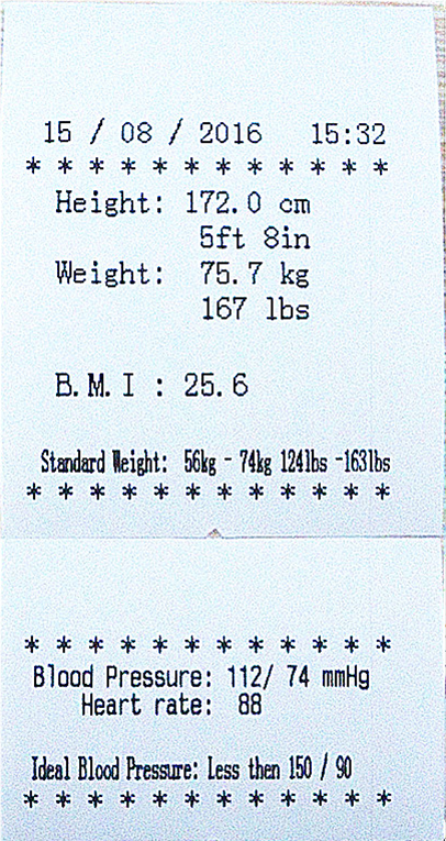 Анализатор измеряя масштаба электронный БМИ высоты и веса человеческого тела цифров с принтером